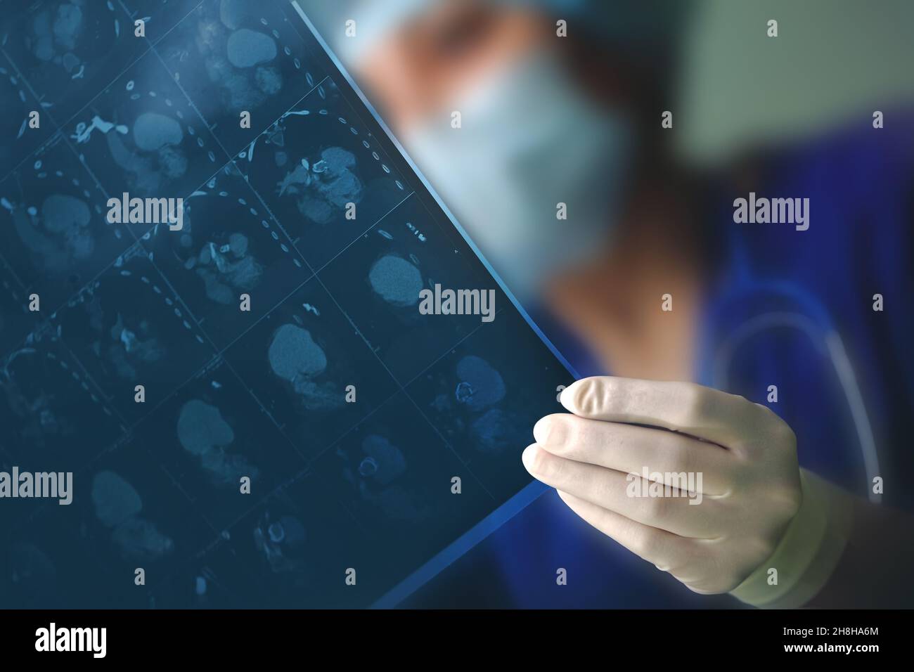 Female doctor scrutinizes patient's scan image. Stock Photo