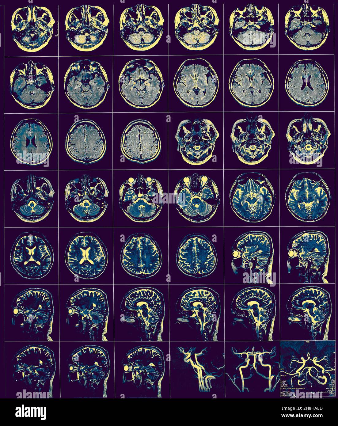 CT film as a medical diagnostics background. Stock Photo