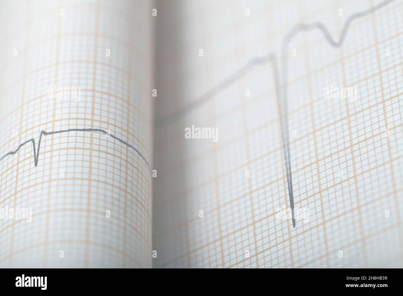 Bended ECG chart, medical background. Stock Photo