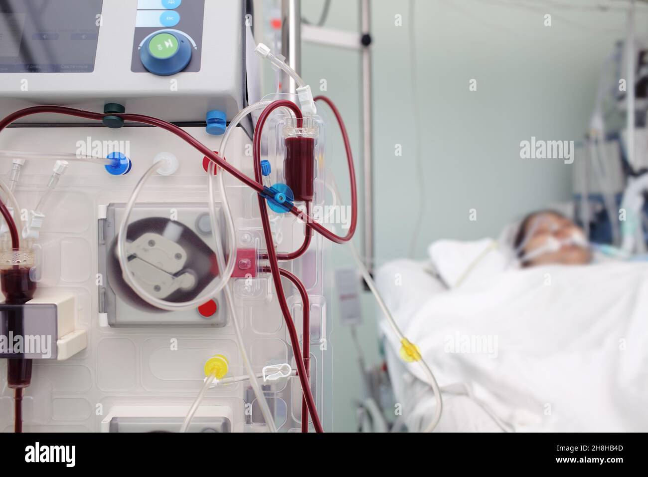 Medical equipment for blood dialysis of a seriously ill patient Stock