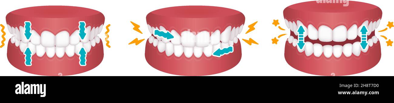Types of bruxism (teeth grinding) vector illustration Stock Vector
