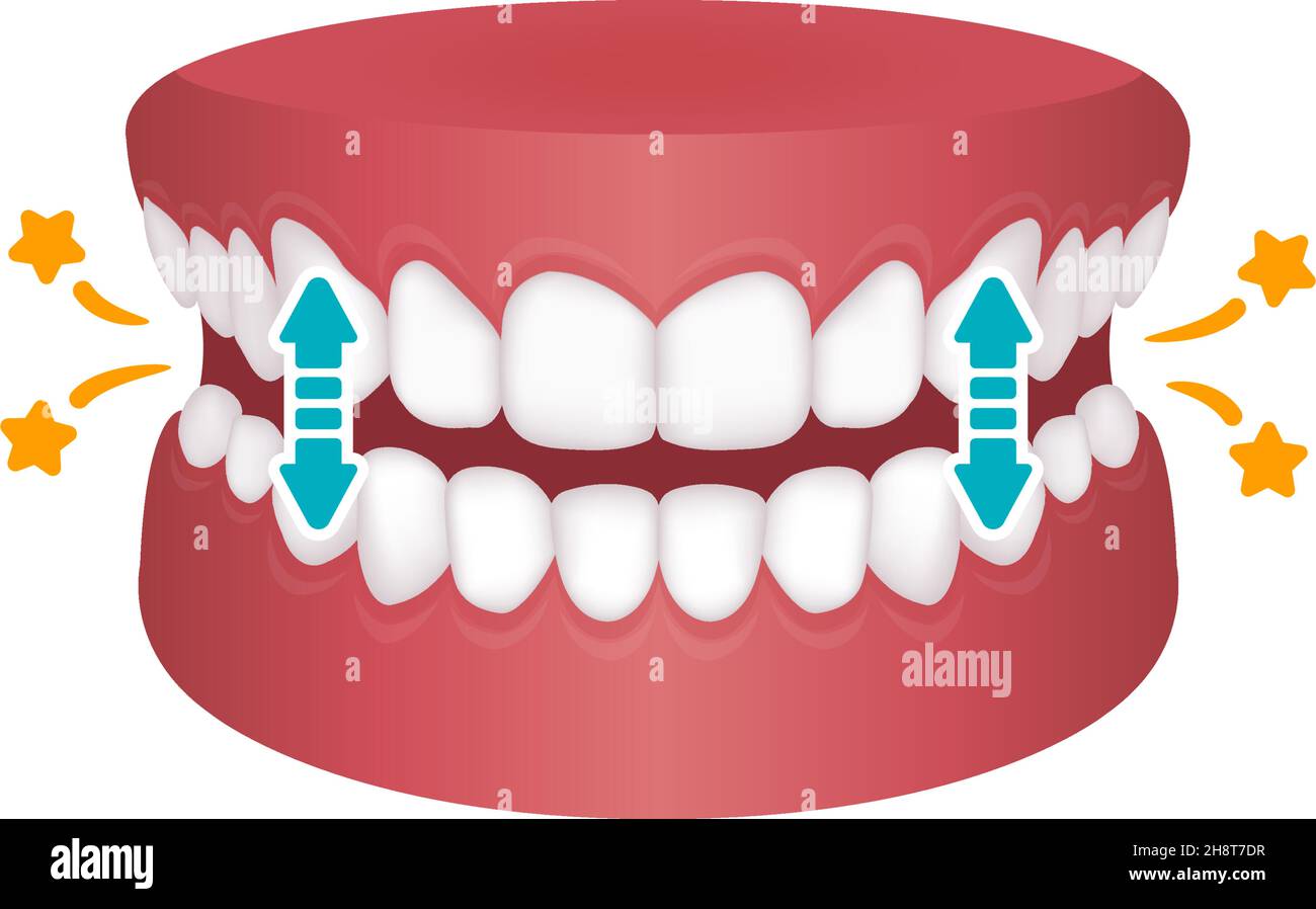 Bruxism vector illustration | tapping teeth Stock Vector