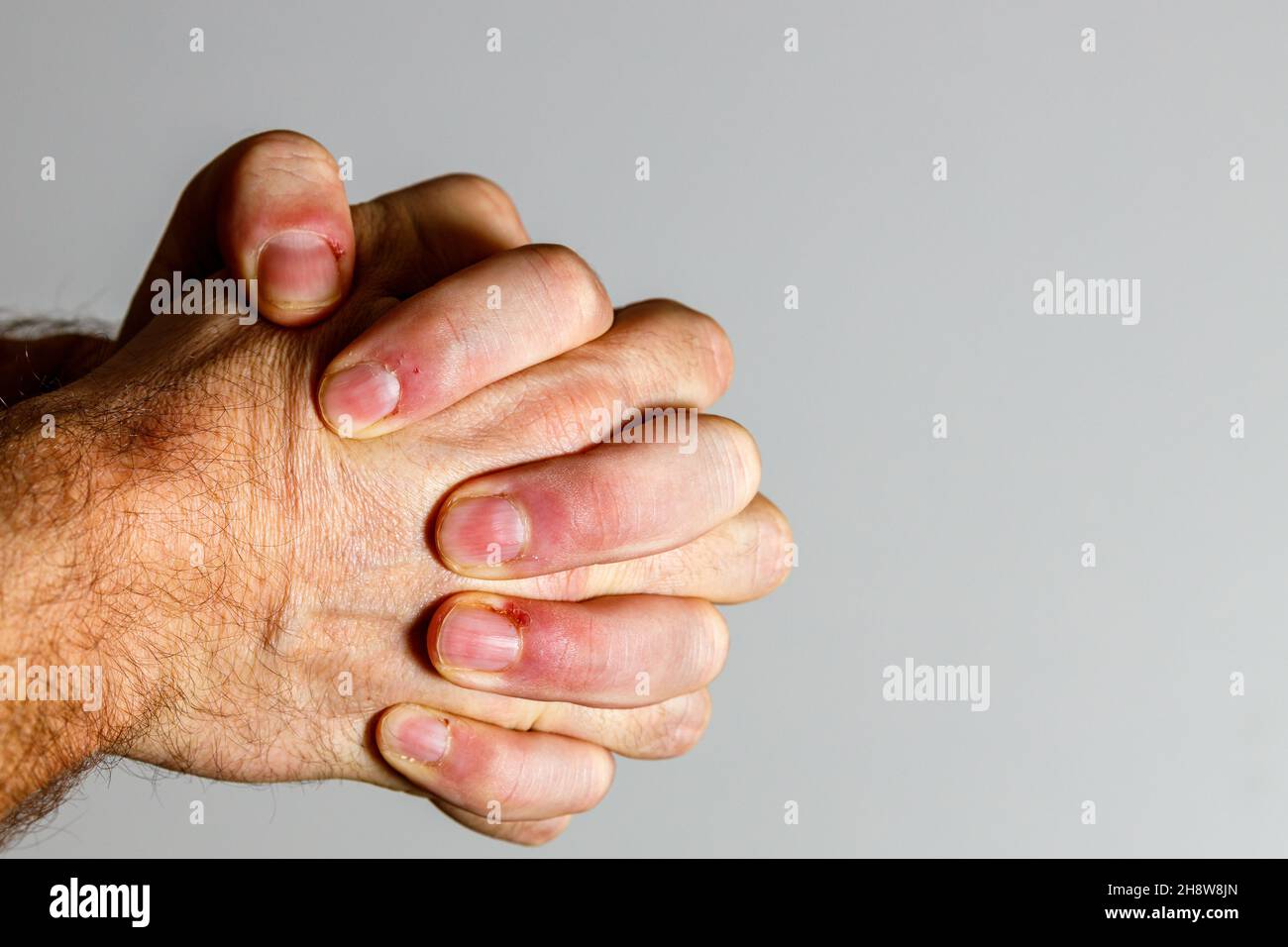 Hand two pointing fingers hi-res stock photography and images - Alamy