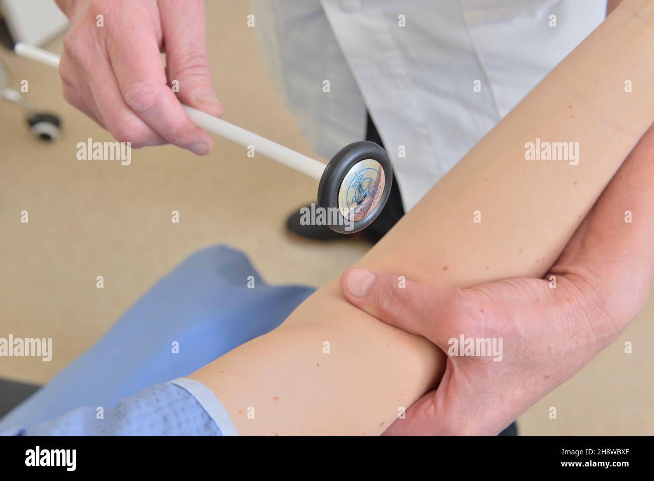 Consultant using a round Head Medical Diagnostic Useful Reflex Hammer on a female patient. Stock Photo