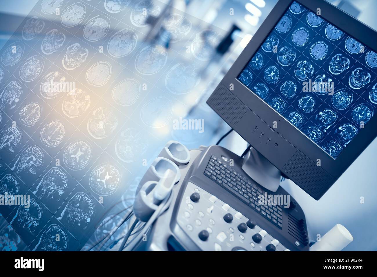 MRI scan result on the display of medical computer and projection of image on the background of hospital hallway. Stock Photo