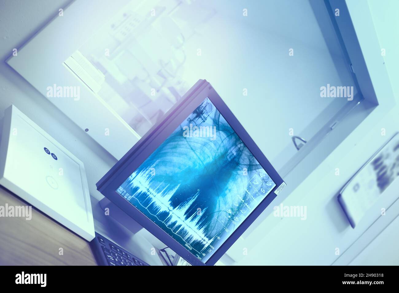 Xray monitoring of the treatment process using modern equipment Stock
