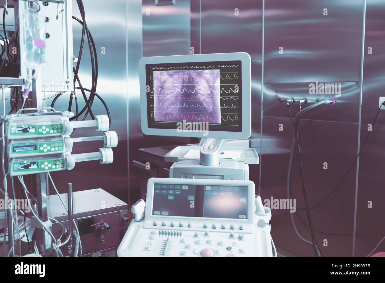 ECG and chest x-ray image on the display of medical computer in the room with steel shiny walls. Stock Photo