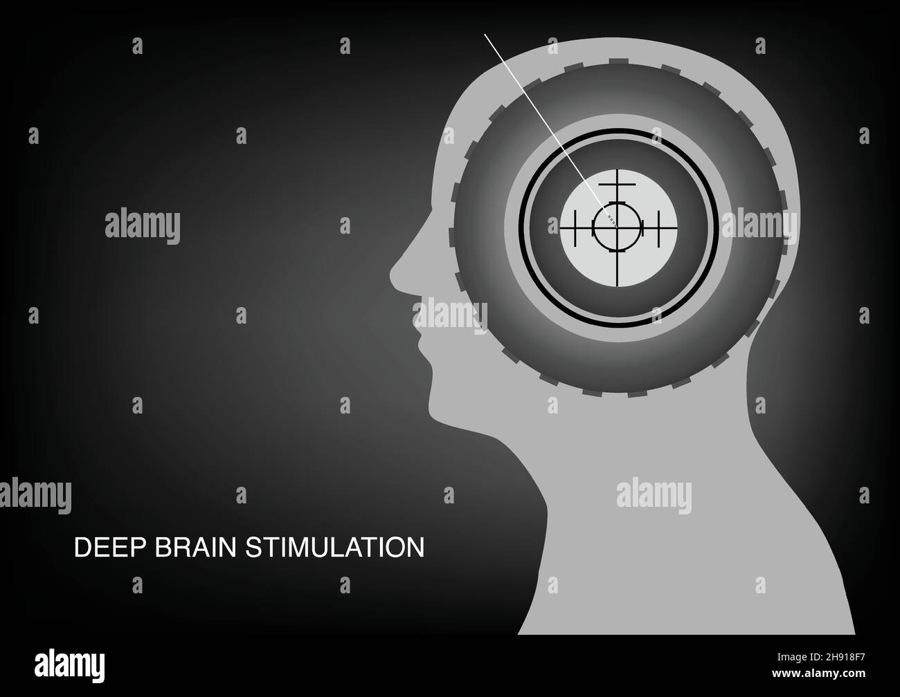 Electrode head Stock Vector Images Alamy