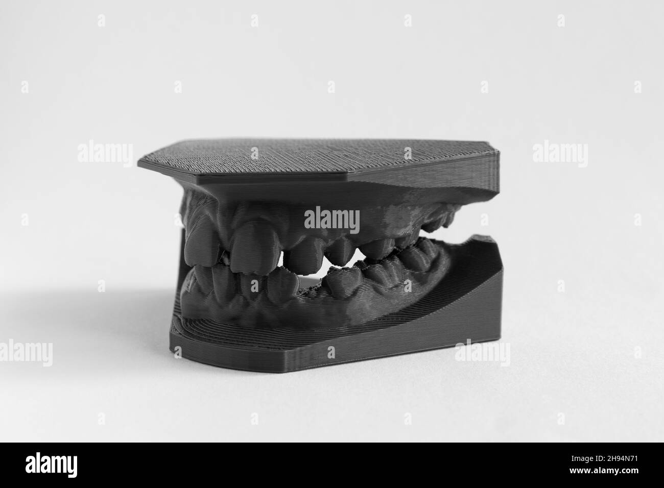 3D printer denture girl 9 years dentistry Stock Photo