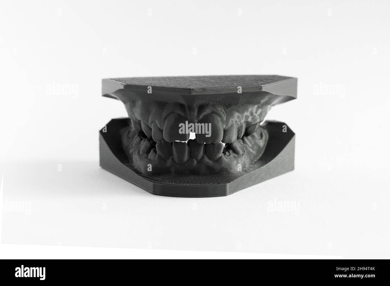3D printer denture girl 9 years dentistry Stock Photo