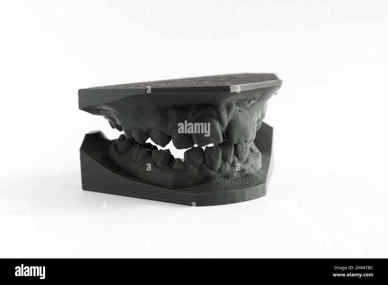 3D printer denture girl 9 years dentistry Stock Photo
