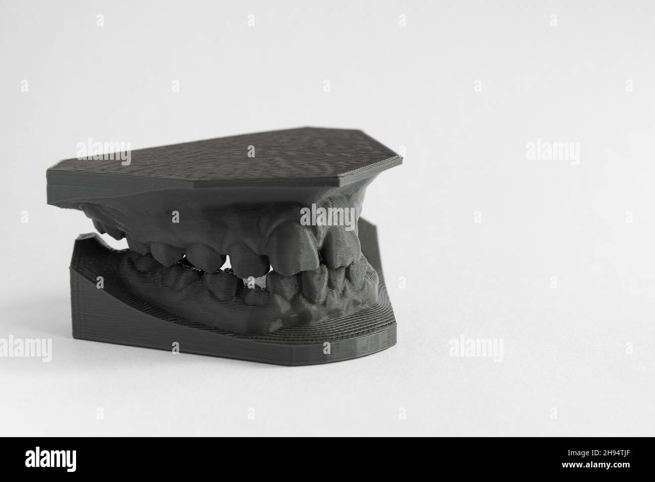 3D printer denture girl 9 years dentistry Stock Photo