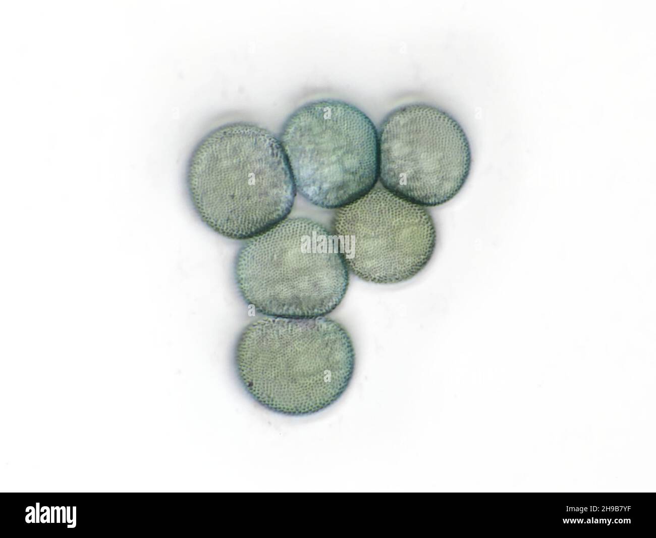 Moss spores under the microscope, horizontal field of view is about 0.10mm Stock Photo