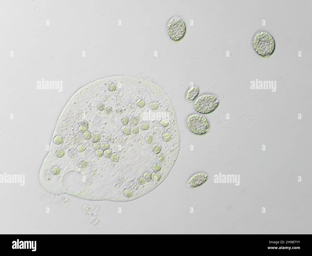 Photomicrograph of various ciliates in a water sample, horizontal field of view is about 0.24mm Stock Photo