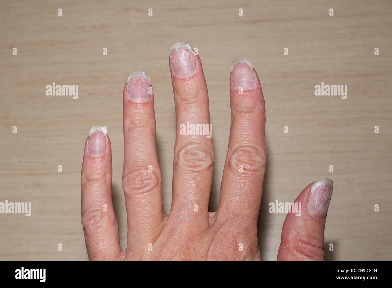 Update 143+ nails without nail paint latest ceg.edu.vn