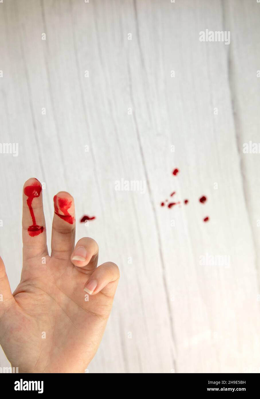 hand injury with blood, blood wound cut top view, copy space, medical concept needs stitches Stock Photo
