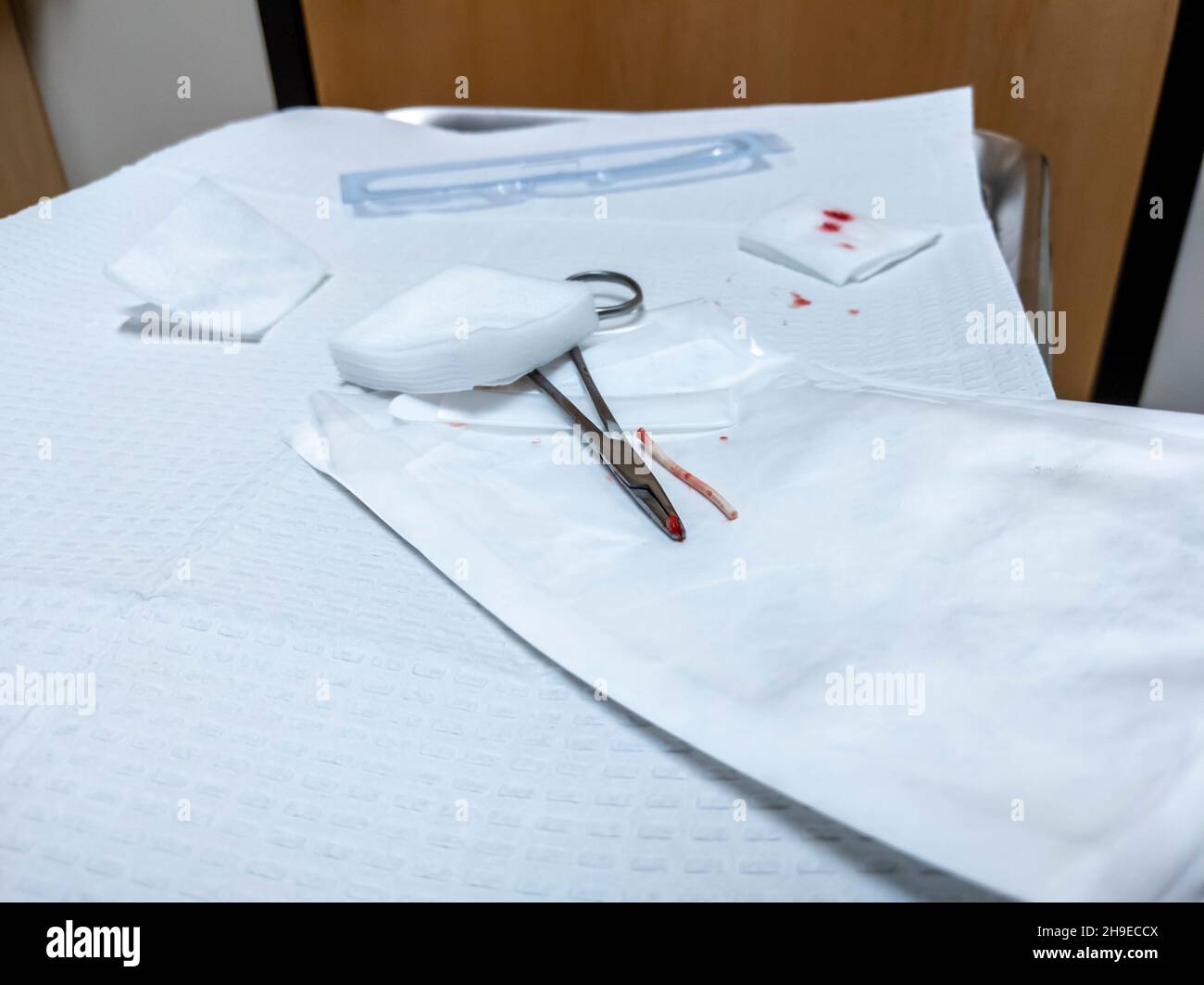 View of a birth control arm implant, freshly removed, sitting on a