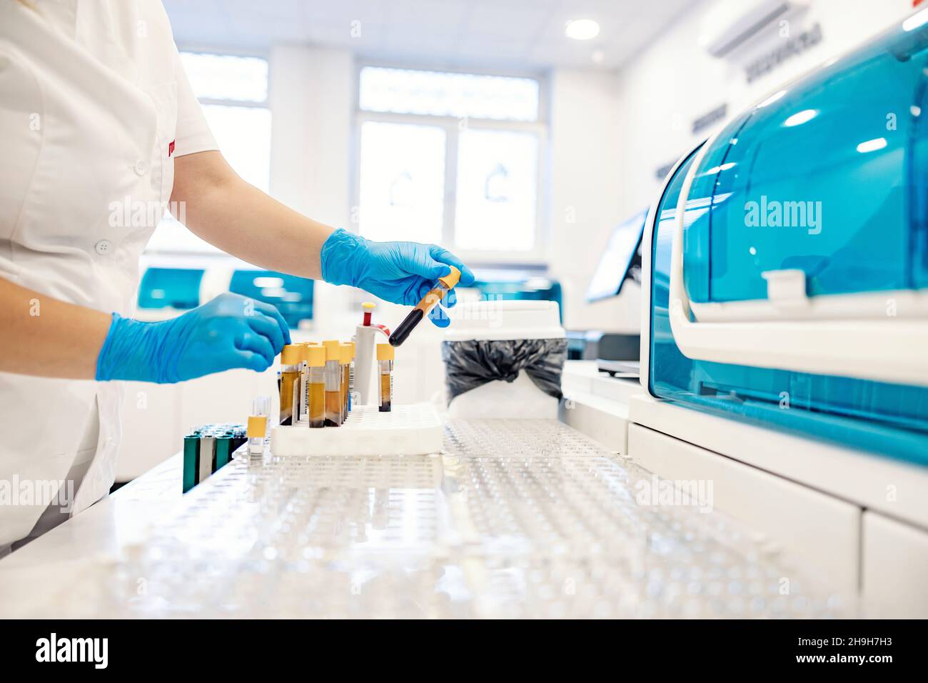 Blood samples in a lab. A microbiologist takes a test tube with a blood