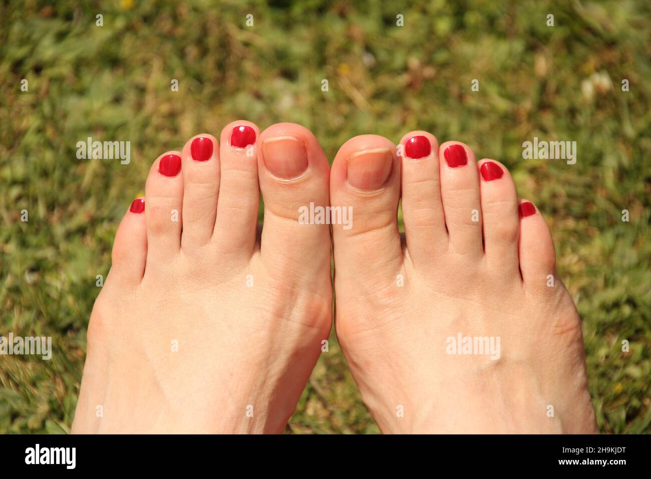 Closeup shot of female feet with all toes except the big toes painted ...