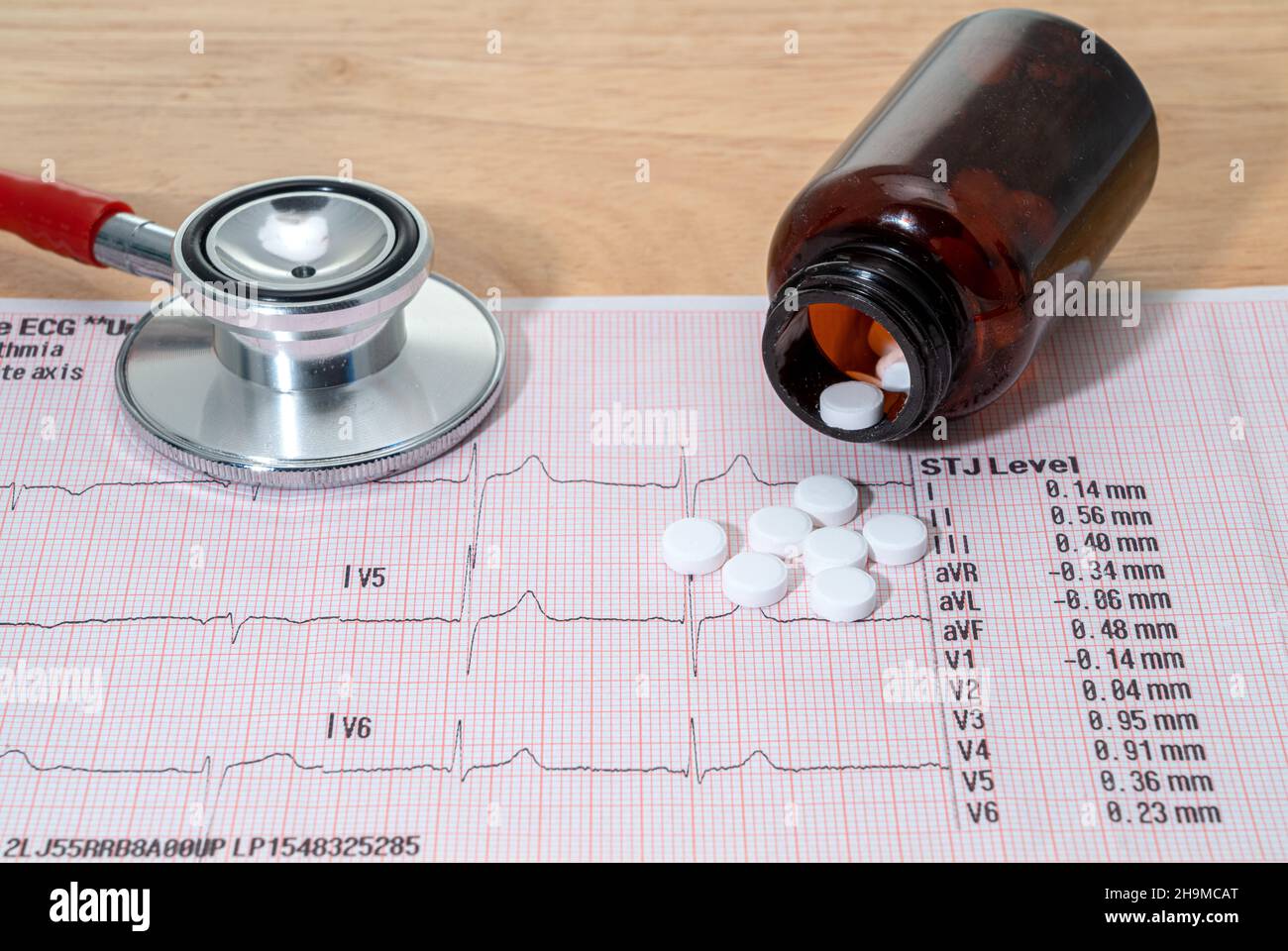 An ECG test chart with pills and a stethoscope Stock Photo