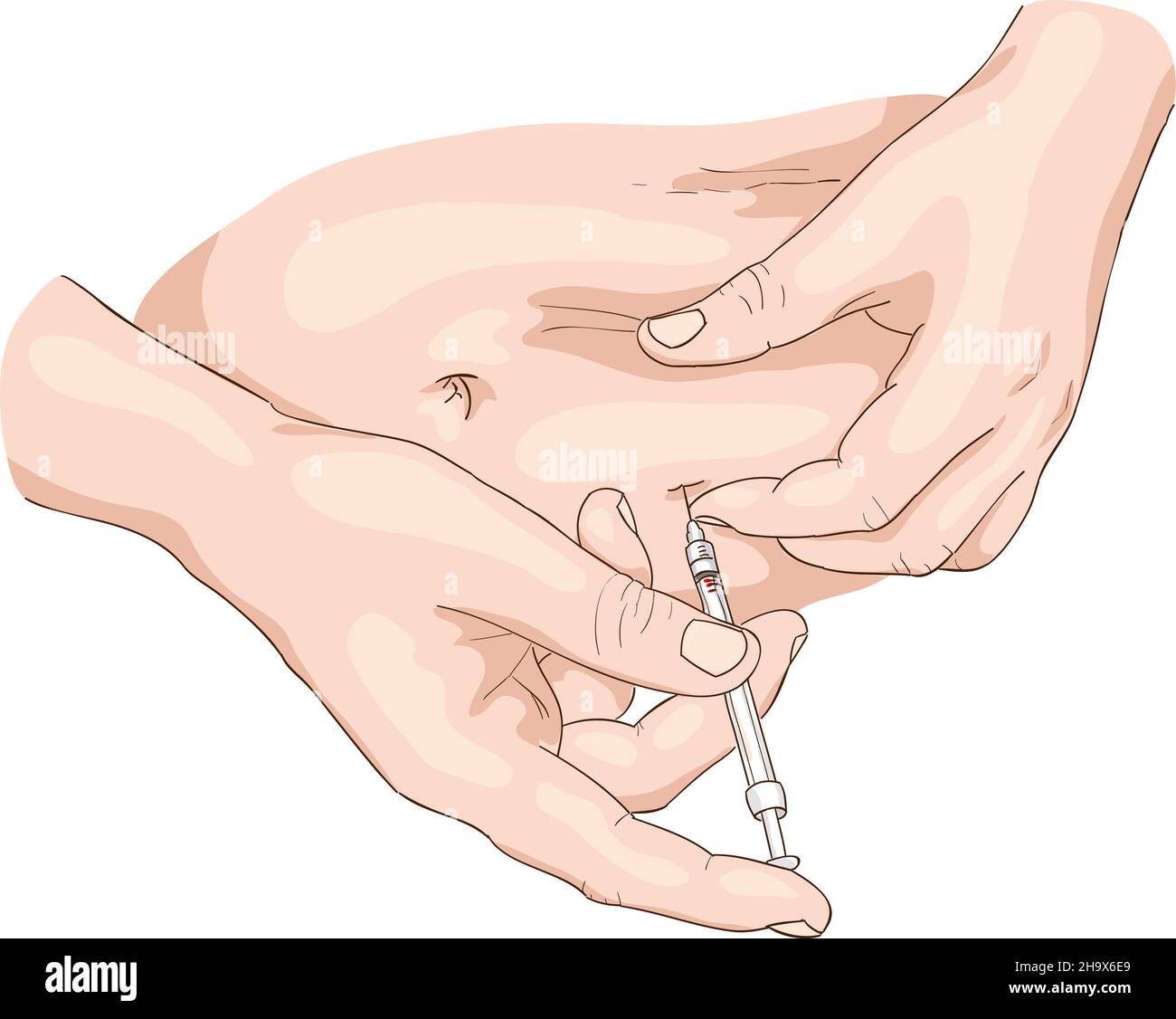 Insulin injection in a belly. Vector illustration. Stock Vector