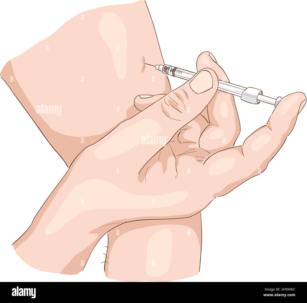 Insulin injection in a shoulder. Vector illustration. Stock Vector