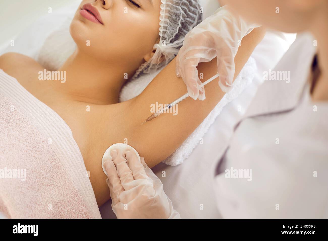 Doctor injecting botox in underarm area to treat hyperhidrosis and reduce body odor Stock Photo