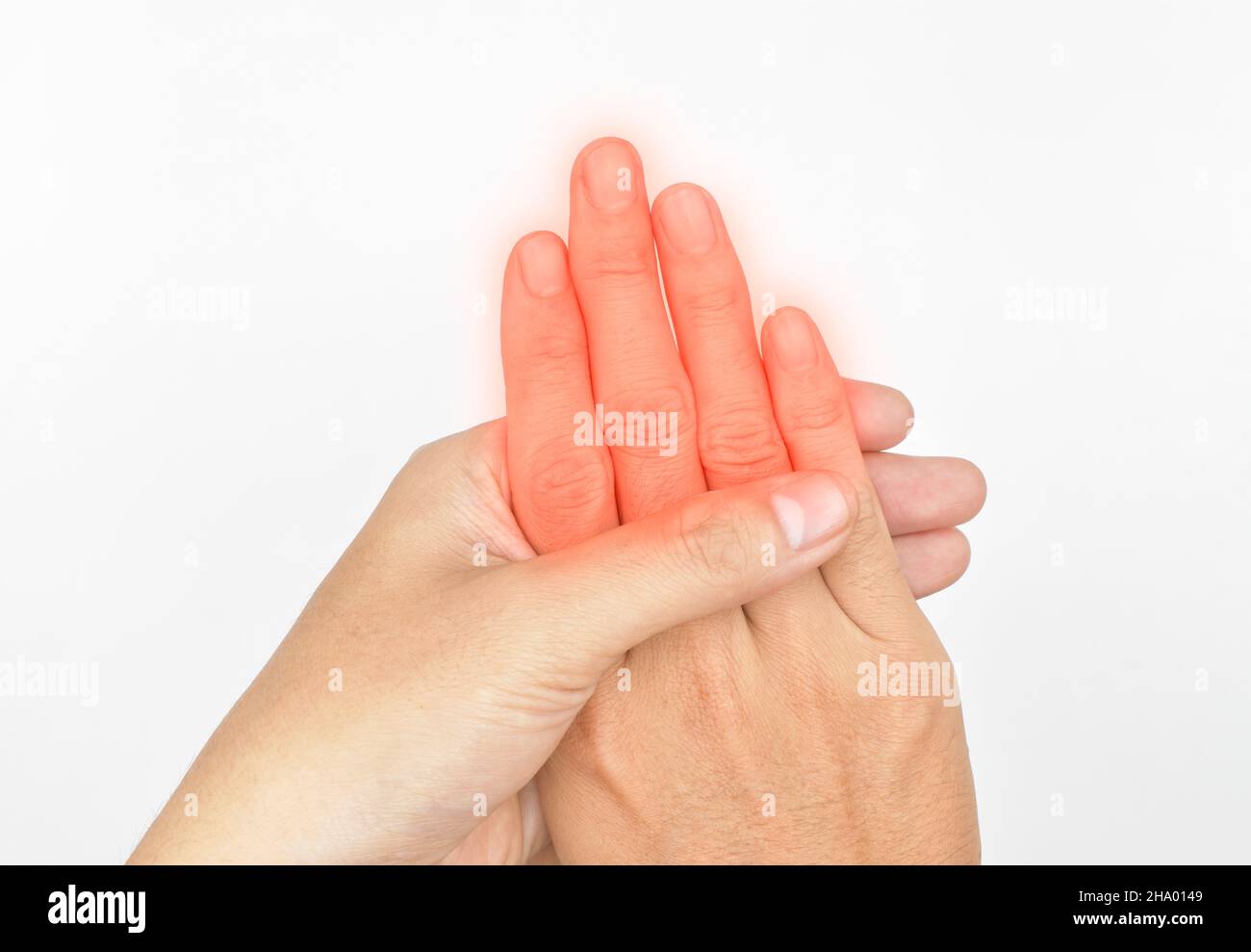 Inflammation of Asian young man’s fingers and hand. Concept of hand