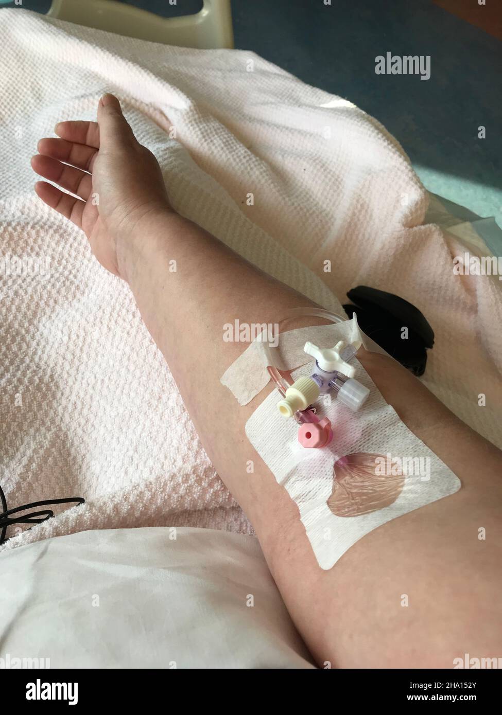 An IV or drip intravenous in the arm of a patient lying on a hospitalbed Stock Photo