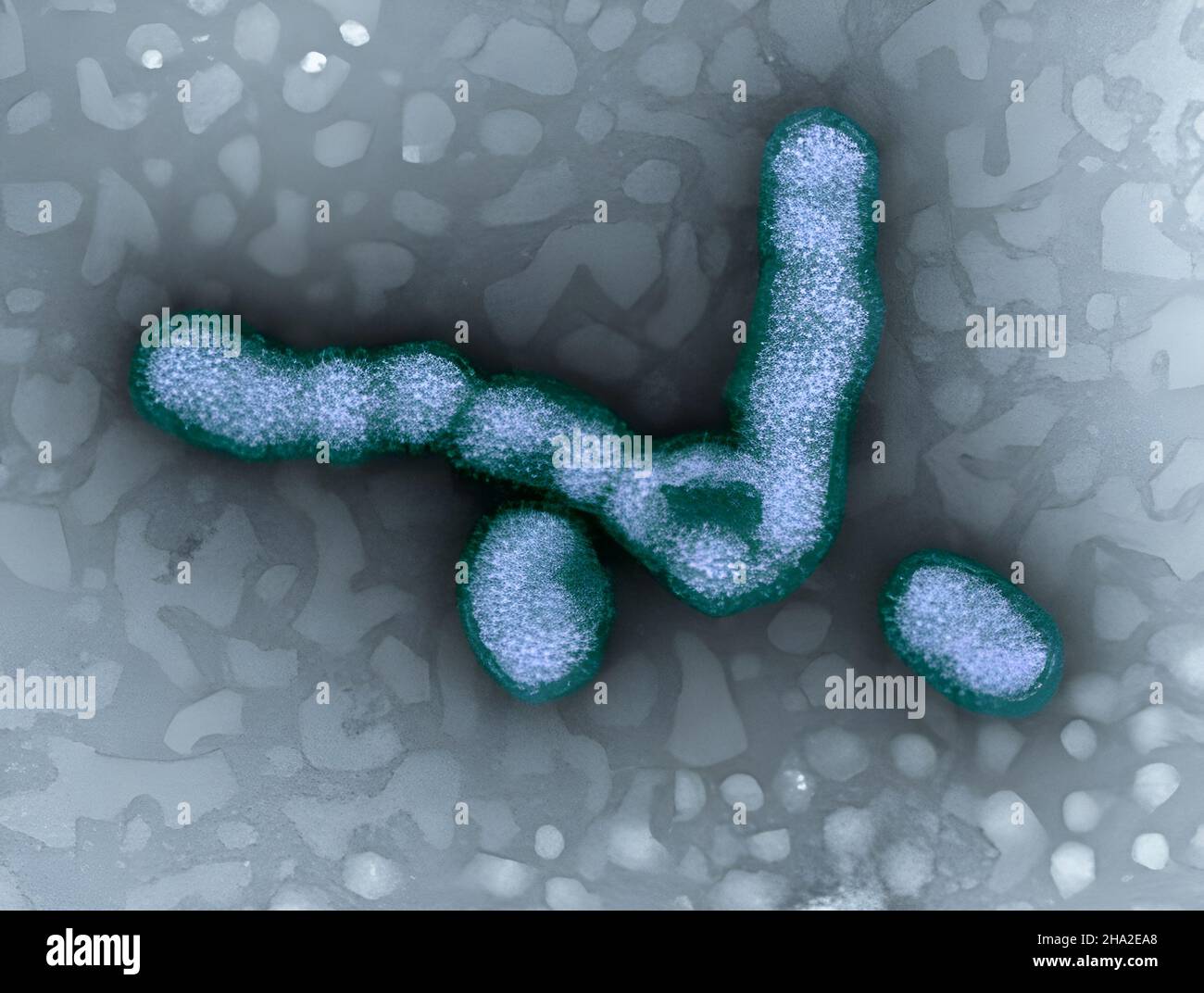 Virus microscope hi-res stock photography and images - Alamy