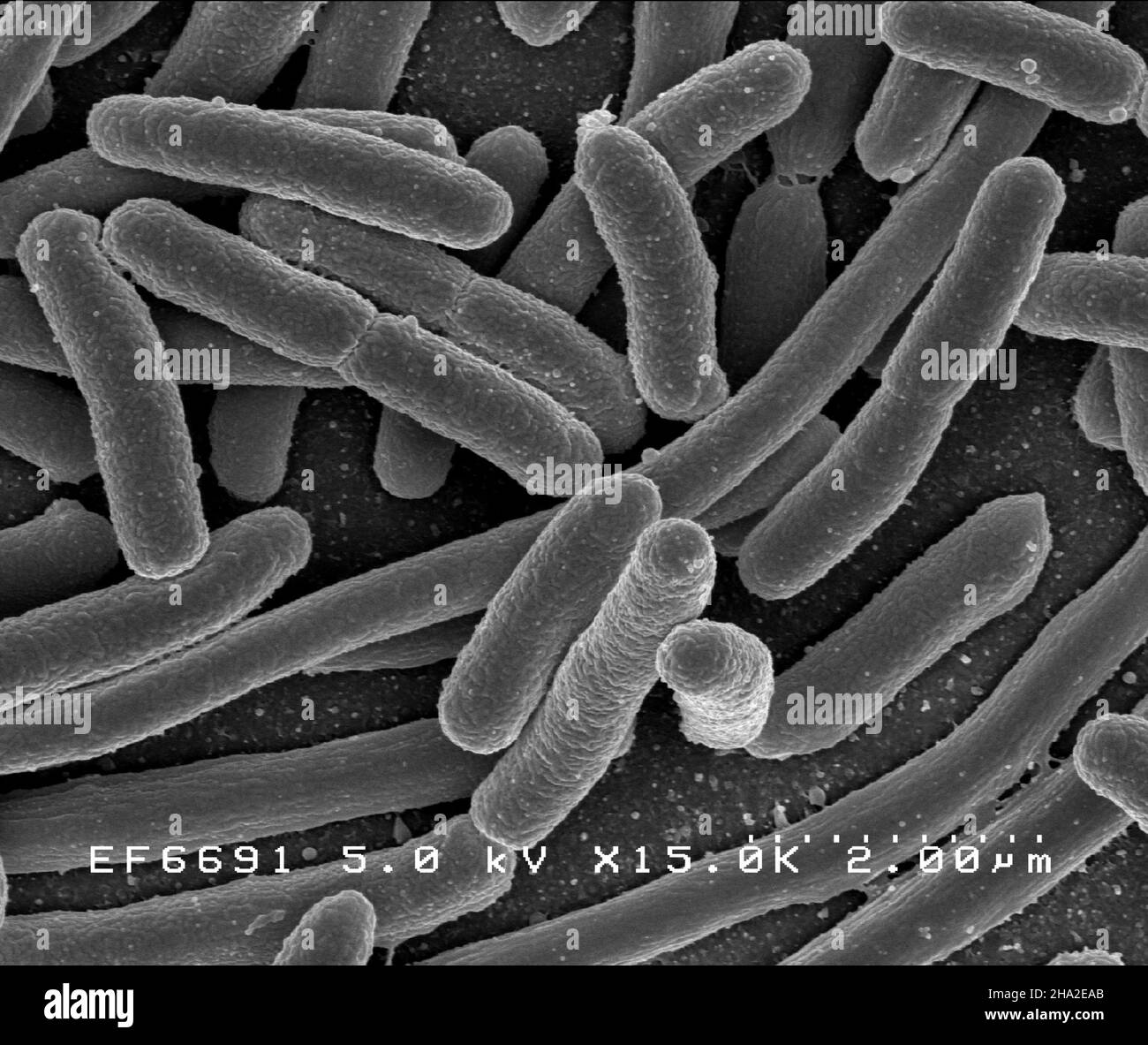 E. coli bacteria Stock Photo