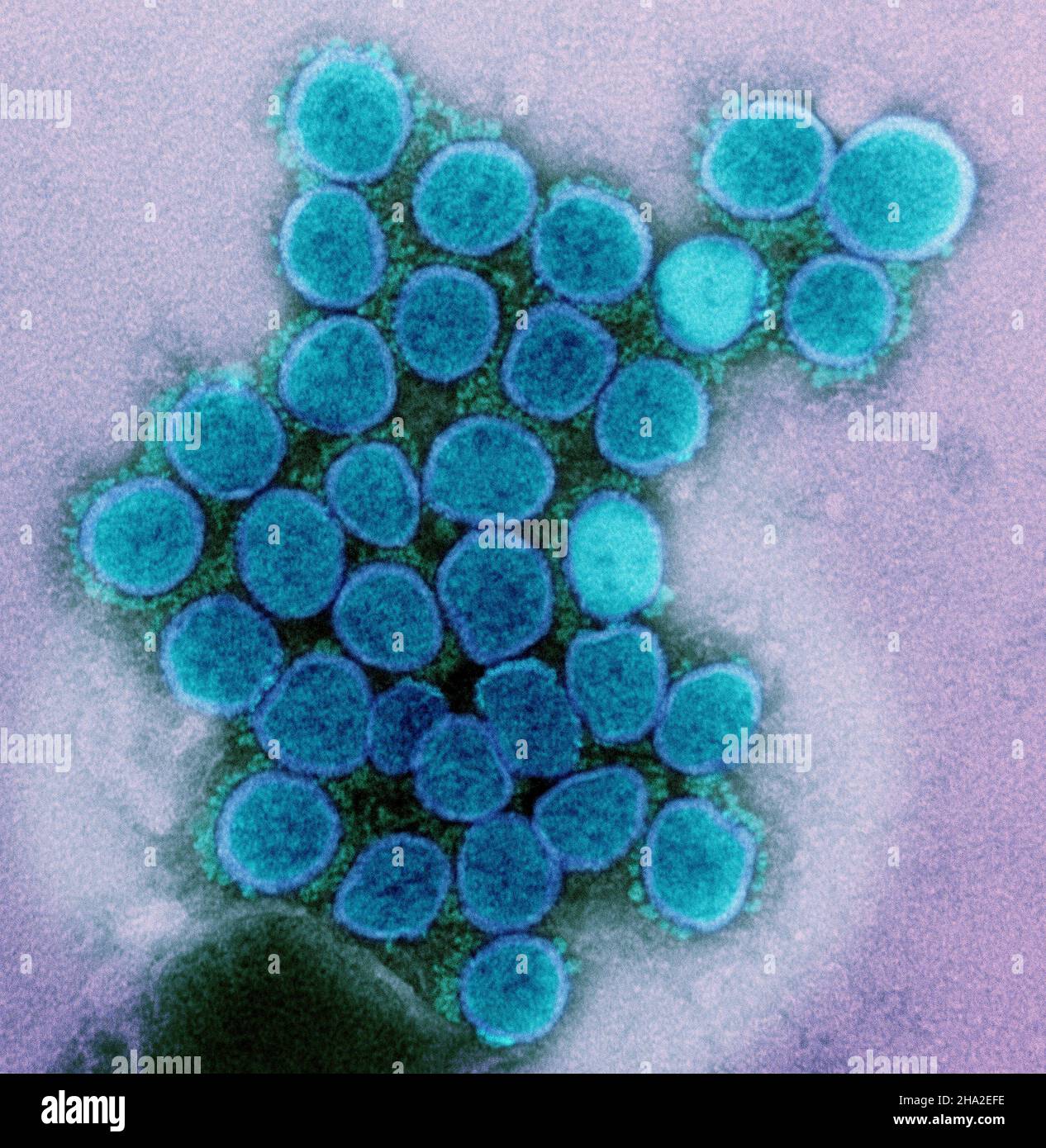 Sars cov 2 hi-res stock photography and images - Alamy
