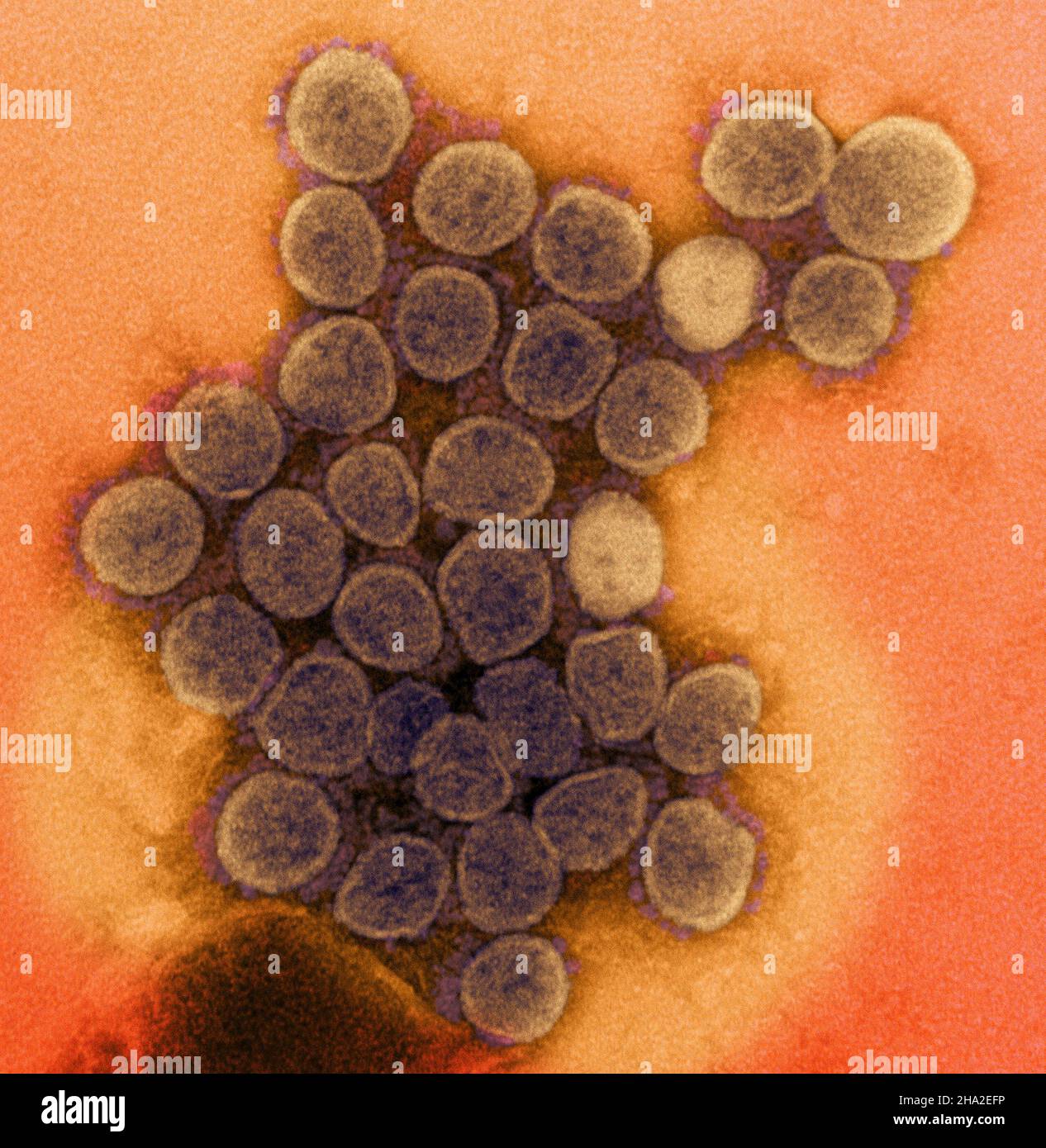 Novel coronavirus sars-cov-2 Stock Photo