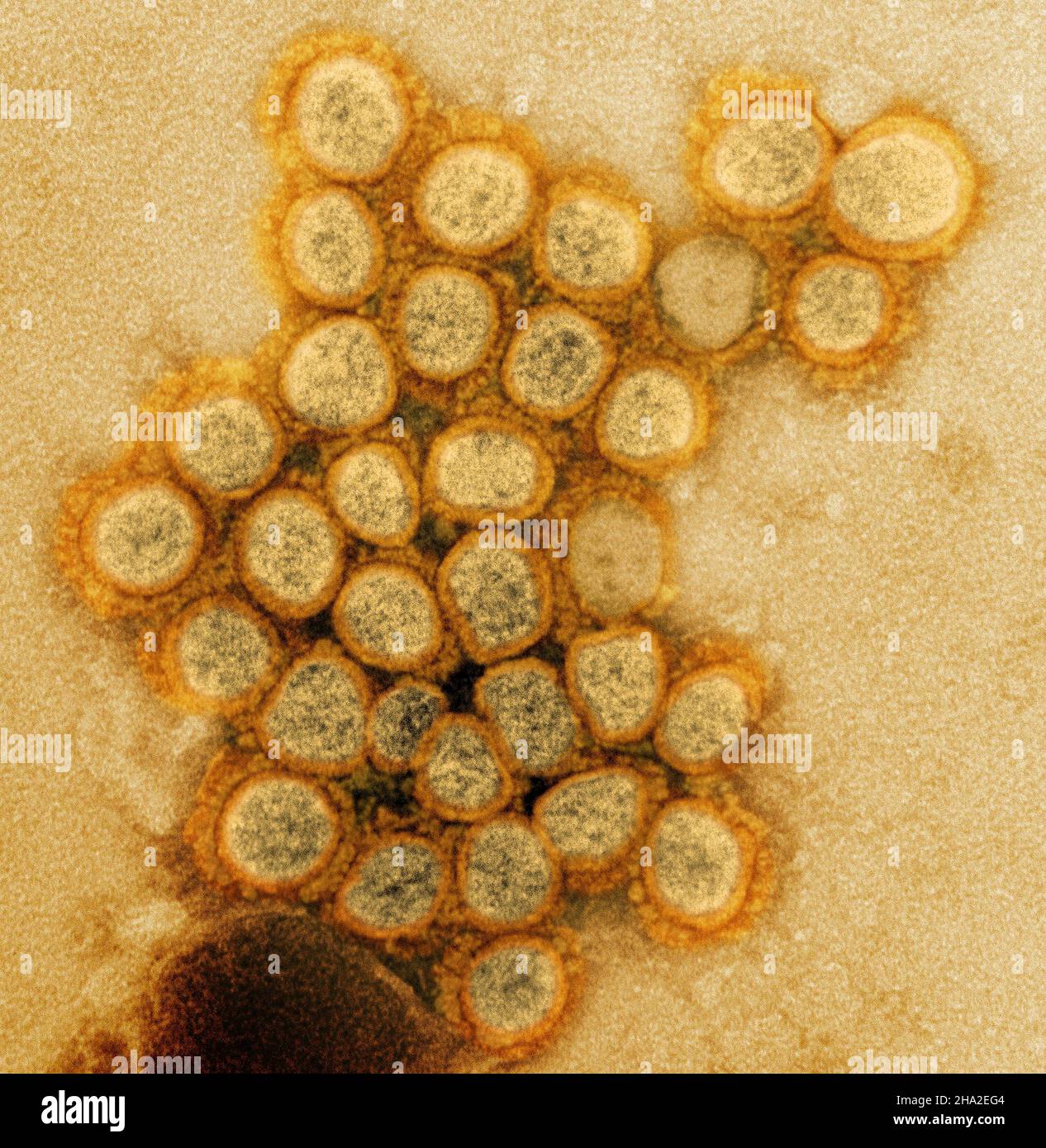 Novel coronavirus sars-cov-2 Stock Photo - Alamy