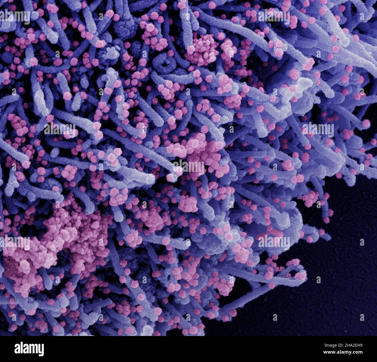 Colorized scanning electron micrograph of a cell (purple) infected with ...