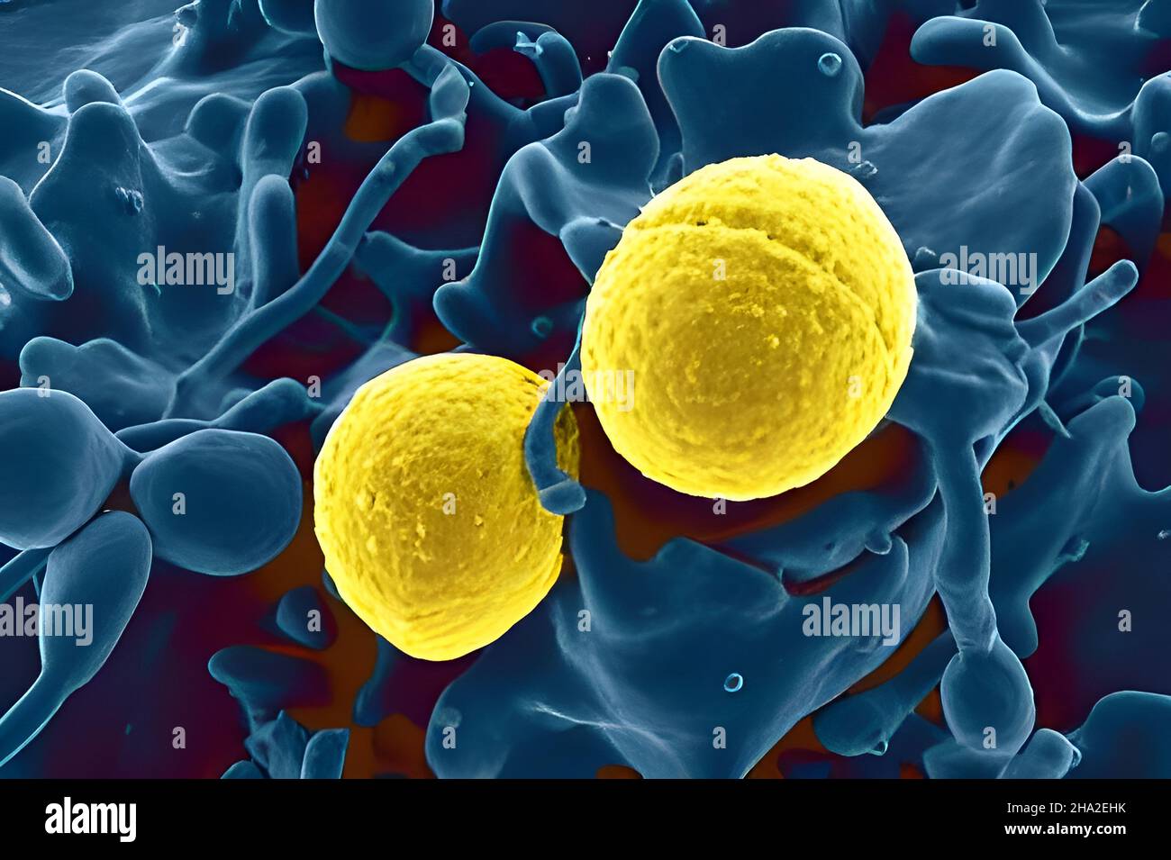 Staphylococcus aureus bacteria Stock Photo