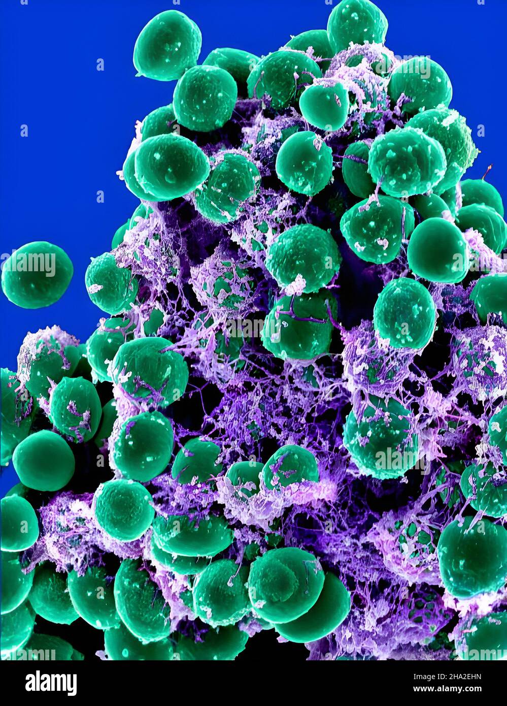 Staphylococcus epidermidis bacteria Stock Photo