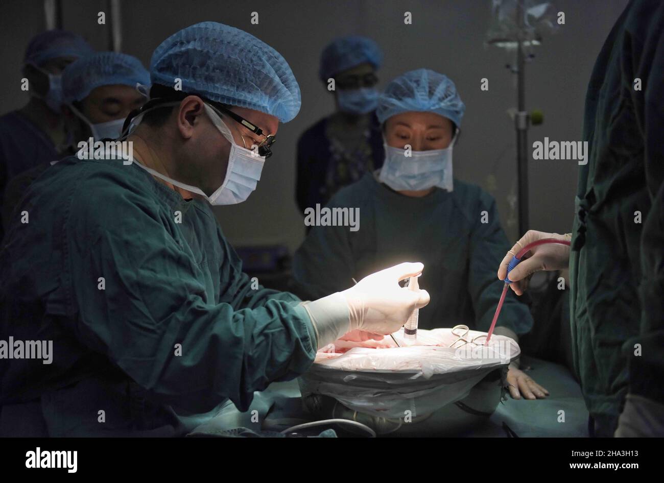 (211210) -- CHENGDU, Dec. 10, 2021 (Xinhua) -- Wang Wentao (L) uses the technology of extracorporeal hepatectomy plus liver autotransplantation in the treatment of a hydatid disease patient at a hospital in Tibetan Autonomous Prefecture of Garze, southwest China's Sichuan Province, Jan. 16, 2020.  Wang Wentao, deputy director of the liver surgery department at West China Hospital of Sichuan University, started his work on the prevention and control of hydatid disease in Tibetan Autonomous Prefecture of Garze in 2006 when he learned that some local people suffer from hydatid disease during one Stock Photo