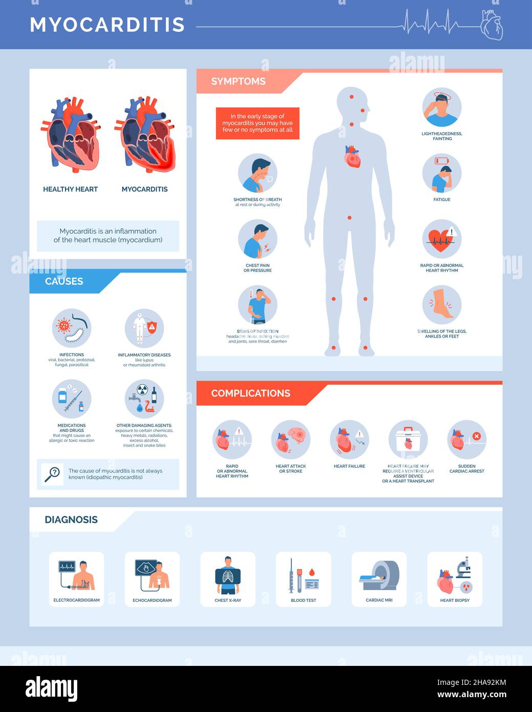 Myocarditis heart inflammation: causes, symptoms, complications and diagnosis, medical infographic with icons Stock Vector
