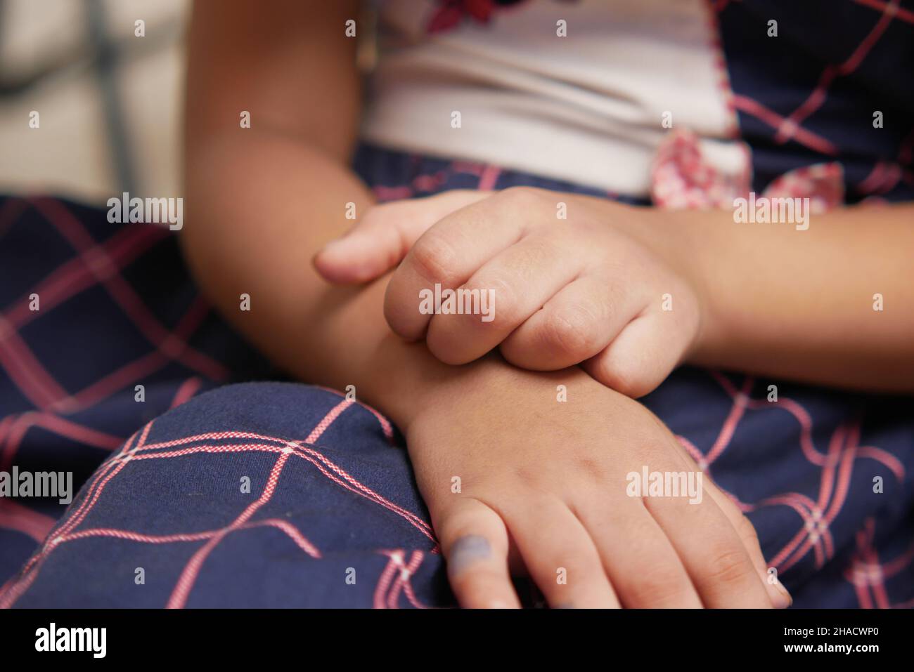 child girl suffering from itching skin on hand Stock Photo Alamy