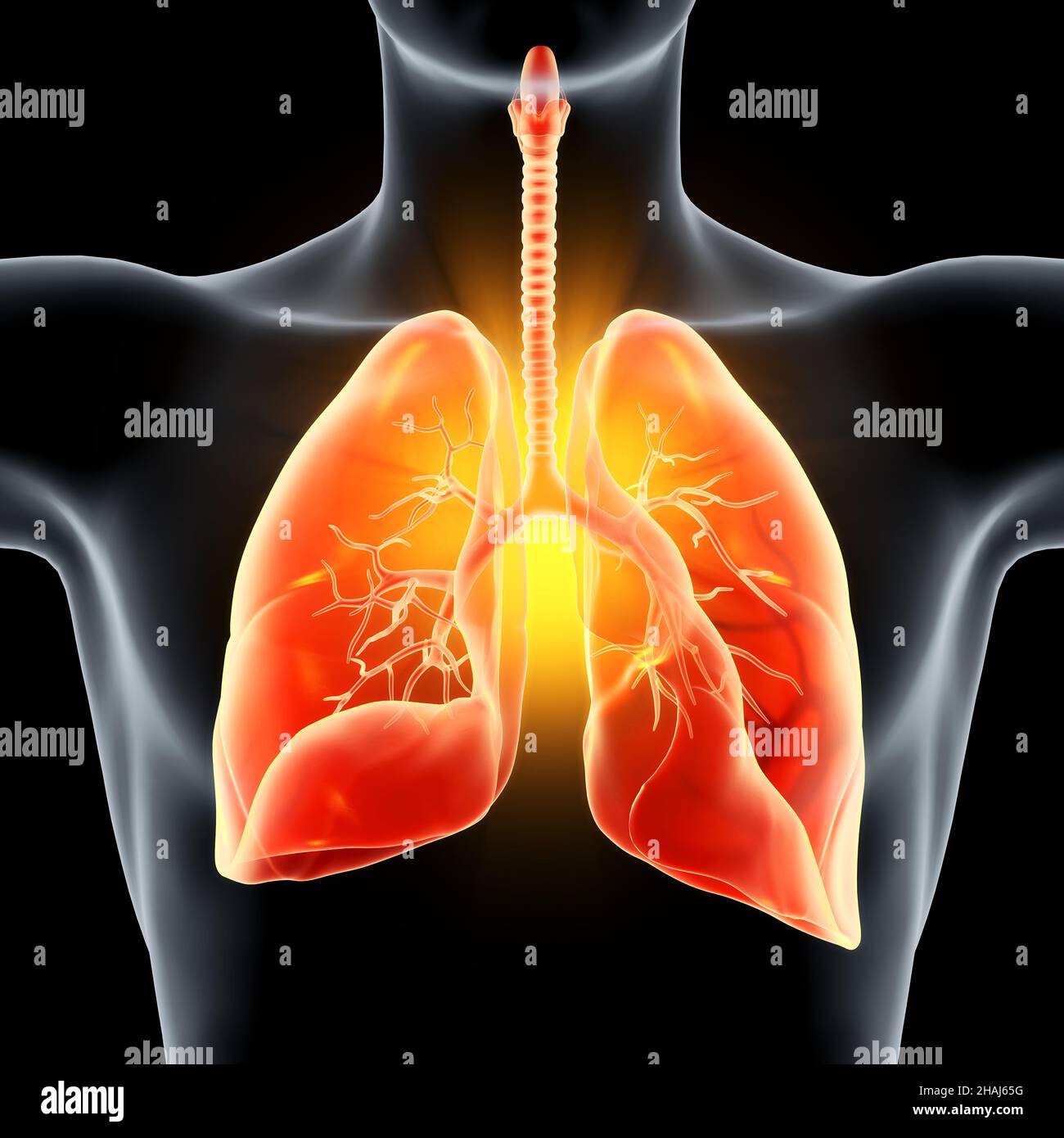 3D Illustration showing pneumonia, infected lungs Stock Photo