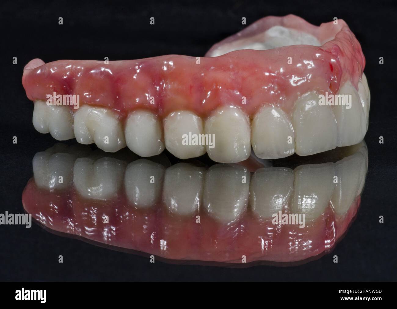 Closeup of an Artificial jaw with teeth, dental bridge isolated on a