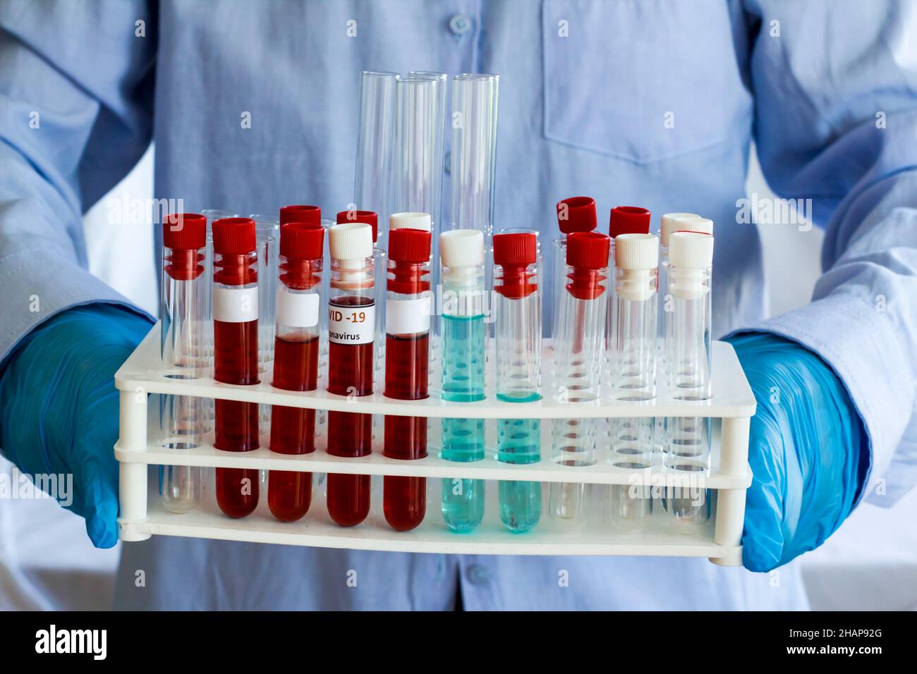 Blue gloved health worker carrying blood tubes stand and one tube has