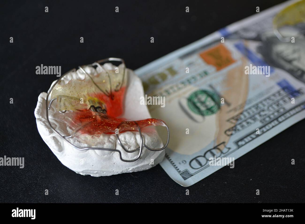 Plaster cast of teeth and dental plate Stock Photo Alamy