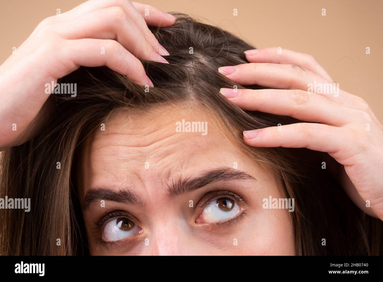 Close up of woman examining her scalp and hair, hair loss on hairline or dry scalp problem Stock Photo - Alamy Close up of woman examining her scalp and hair, hair loss on hairline or dry scalp problem Stock Photo - Alamy
