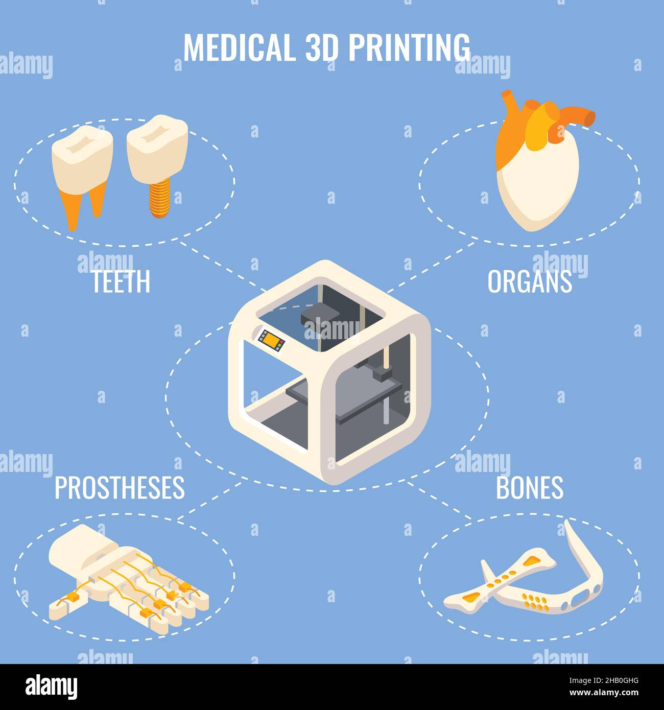 Medical 3d printing concept vector isometric illustration Stock Vector ...