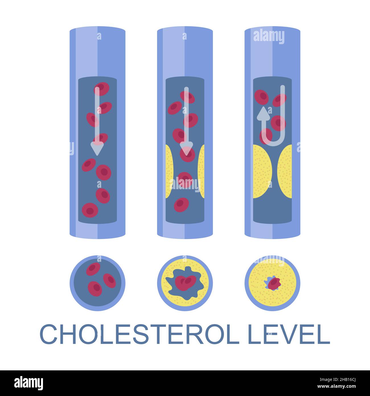 Low, normal, high cholesterol level, vector illustration. High ldl risk