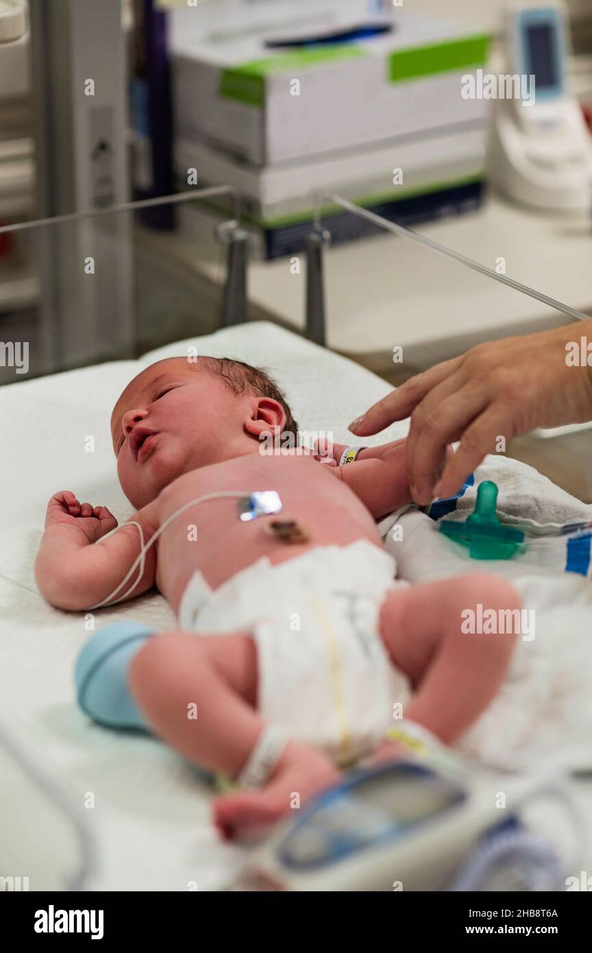 Infant baby girl (0-1 months) being examined with electrodes Stock Photo