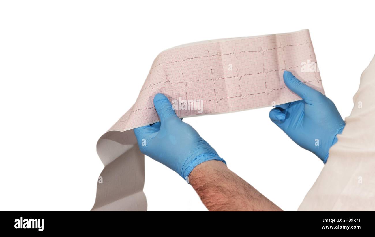 Heart cardiogram in the hands of a doctor. Doctor analyzes heart ...