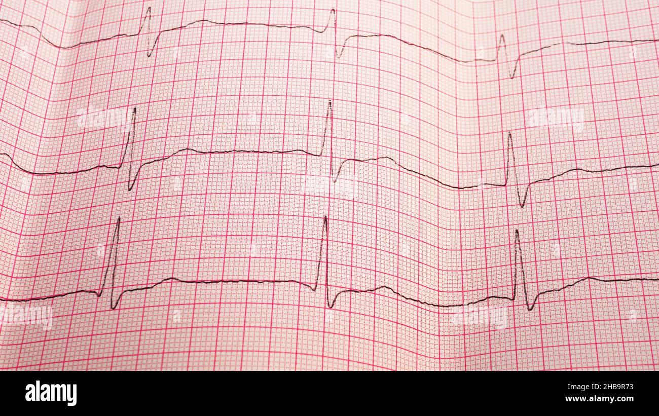 Heart cardiogram in the hands of a doctor. Doctor analyzes heart ...